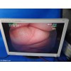 FUJIFILM  EB-530H  BRONCHOSCOPE