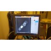 Philips Essenta DR Room
