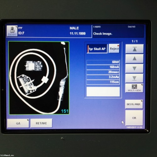 SHIMADZU MobileDArt MUX-100D Portable X-ray