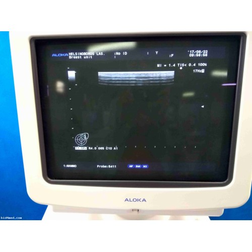 ALOKA ProSound Alpha 10 ultrasound machine