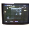 ALOKA ProSound Alpha 10 ultrasound machine