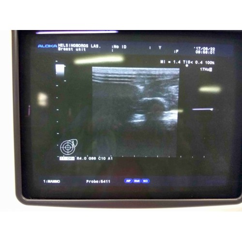 ALOKA ProSound Alpha 10 ultrasound machine