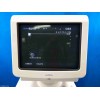 ALOKA ProSound Alpha 10 ultrasound machine