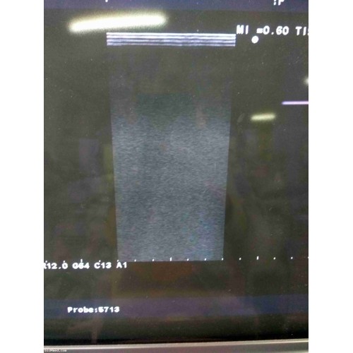 ALOKA ProSound Alpha 10 ultrasound machine