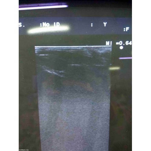ALOKA ProSound Alpha 10 ultrasound machine