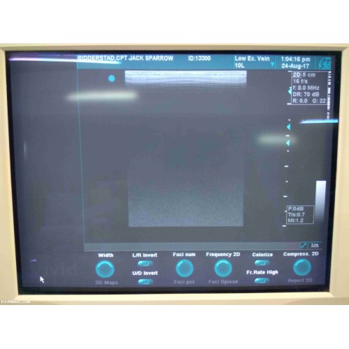 GE  VIVID 3 Ultrasound machine with 4 transducers