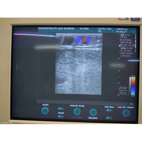 GE  VIVID 3 Ultrasound machine with 4 transducers