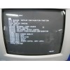 Acuson Aspen ultrasound device